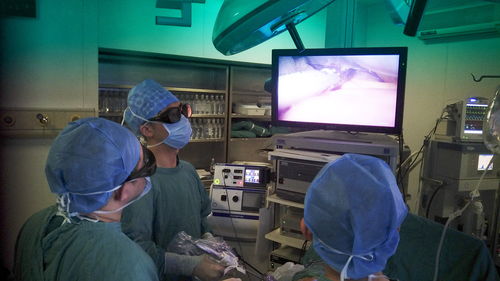 腹腔鏡下肝癌切除術聯合腹腔鏡超聲技術 精準治療肝癌的技術革新與未來展望