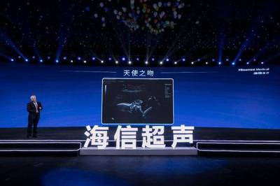 九年磨一劍 海信超聲的夢想征程與技術(shù)突破